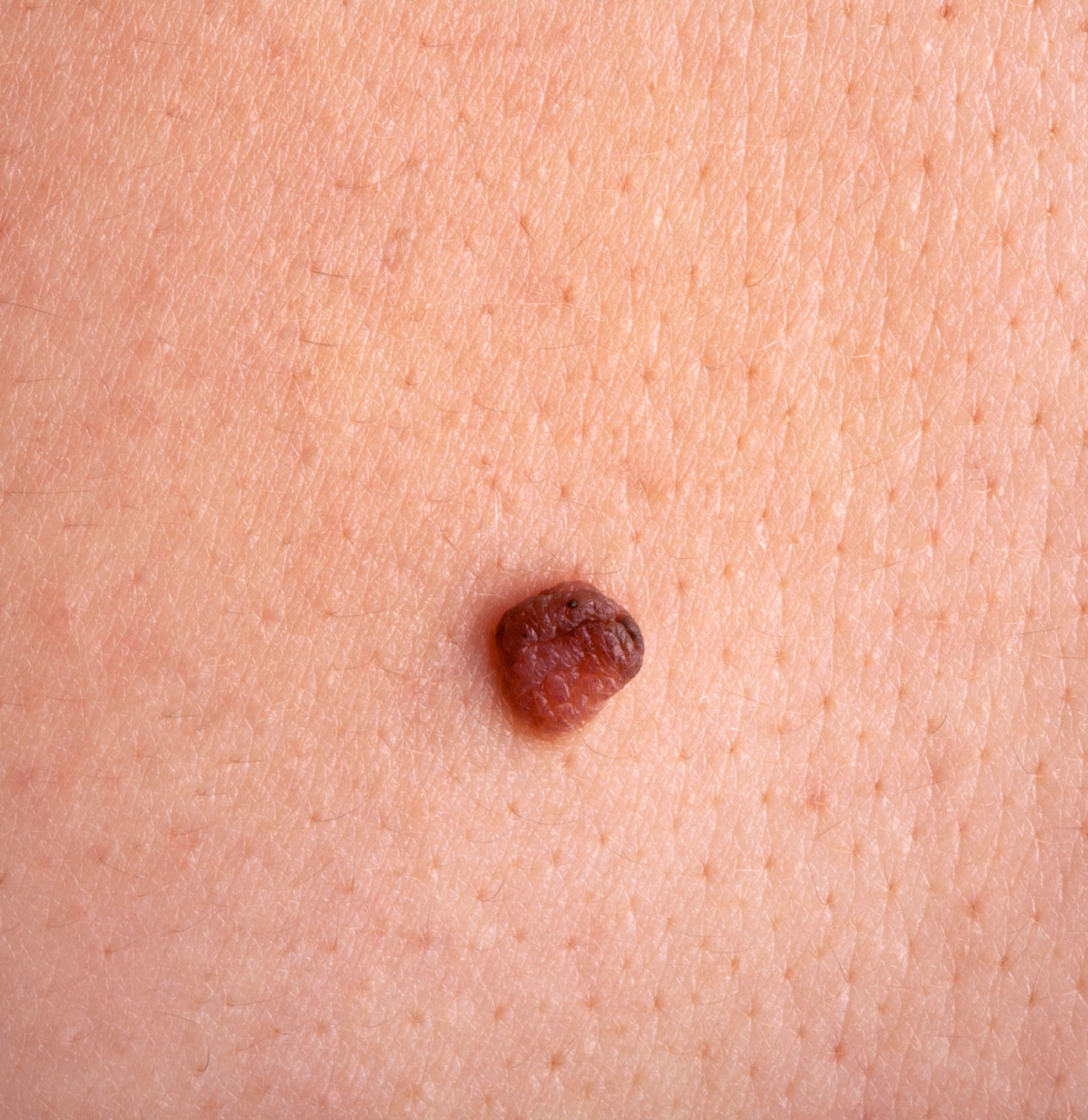 Moles